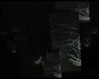 Spleen1